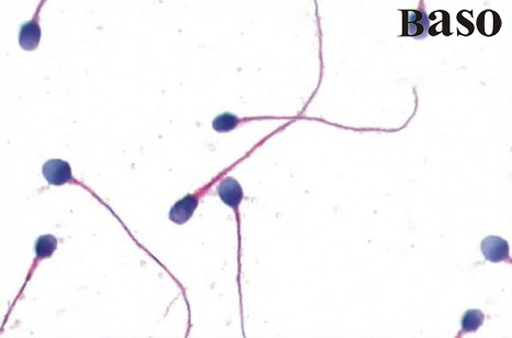 ����(����)�ΑB(t��i)�WȾɫҺ���˜ʰ��Ϸ���